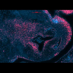 RBP1 gene expression in a CS19 human embryonic heart
